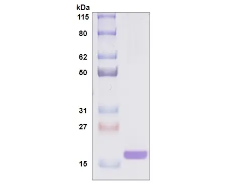 [MC05-050] Recombinant Human Galectin 7, His Tag -50 ug