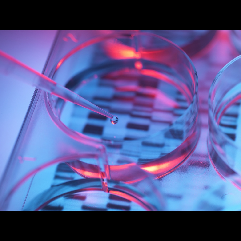[0556-MBC071-R] Amplirun® Streptococcus Agalactiae DNA Control size: 10,000size:20,000 c/µL