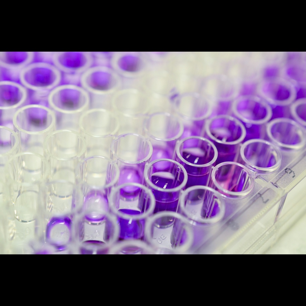 Human 5size:Hydroxyindoleacetic acid  5size:HIAA  ELISA Kit